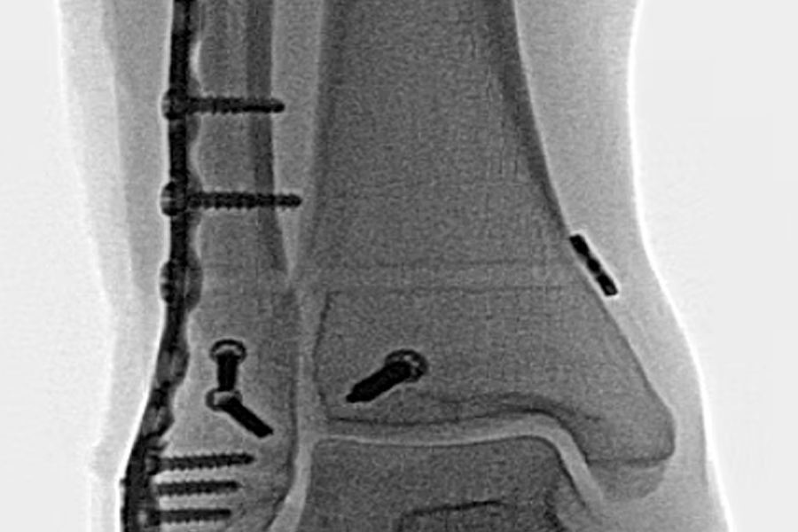 Integrity Orthopedics Fractures