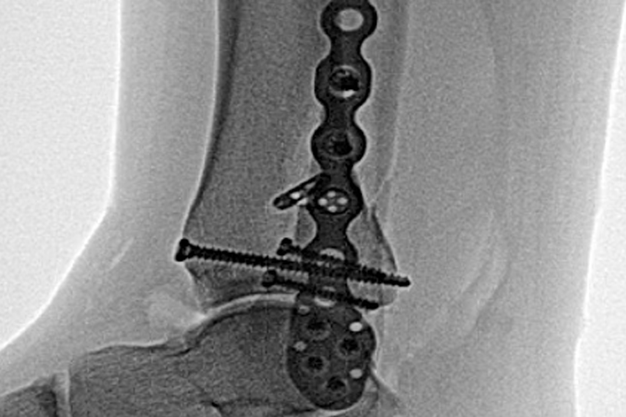 Integrity Orthopedics Fractures