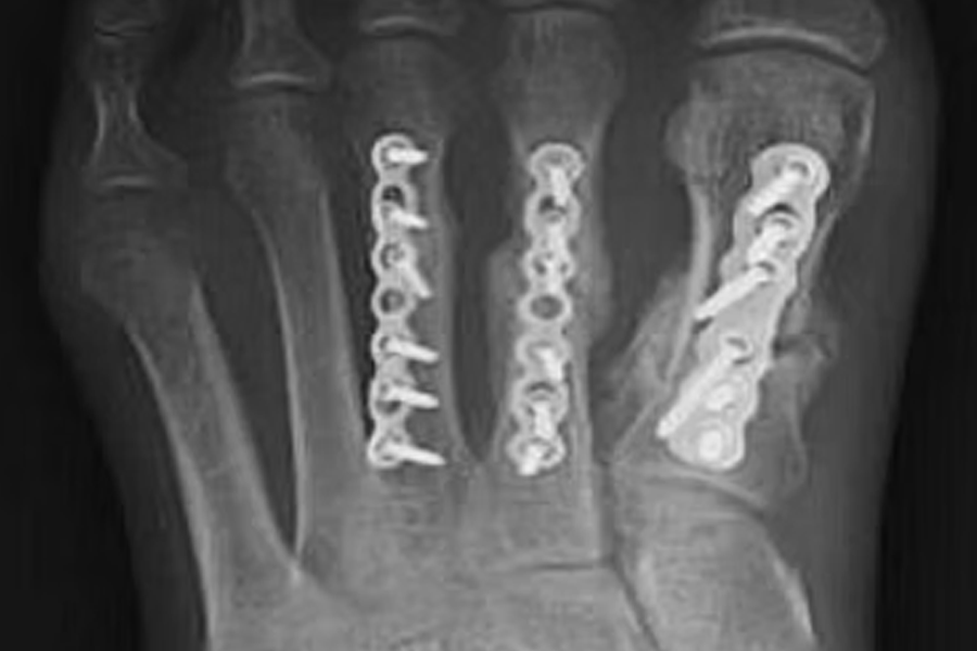Integrity Orthopedics Fractures
